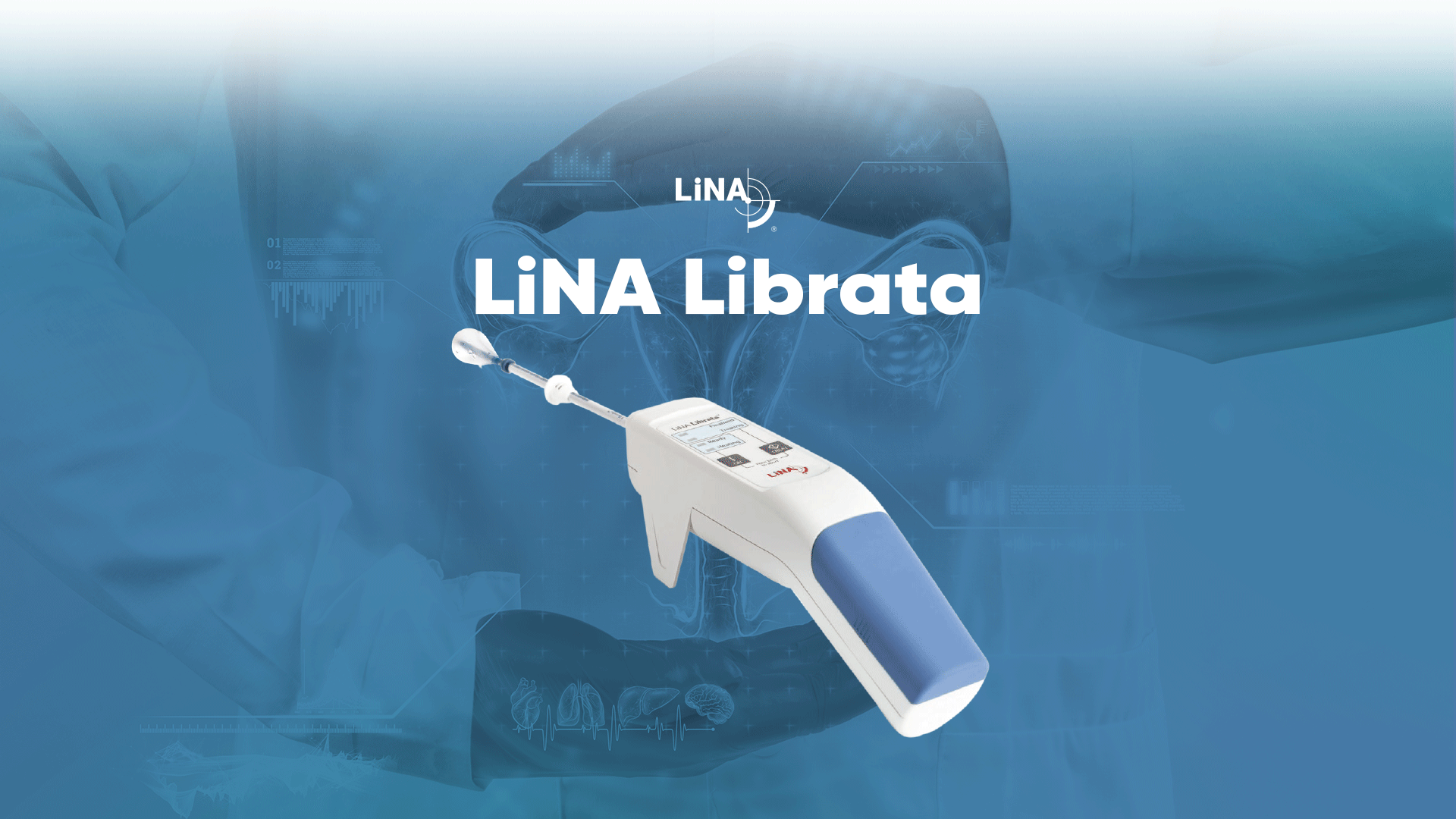 AtakSliderLinaLibrata